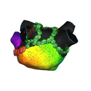 Affera™ mapping system